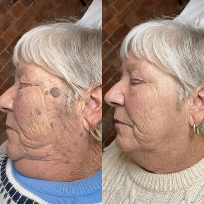 7-day-skin-restoration-serum-pen